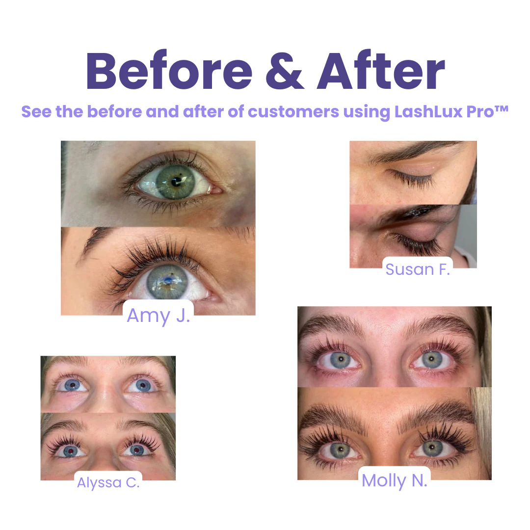 The RapidLash Eyelash Enhancing Serum - Longer Lashes in 7 Days + BUY 1 GET 1 FREE! - Image 3