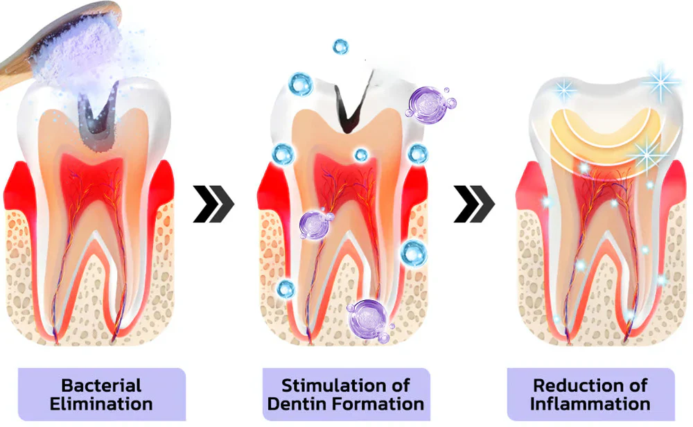 DENTASHIELD – Restore Your Natural Dental Bio-Barrier + 50% OFF FLASH SALE - Image 3