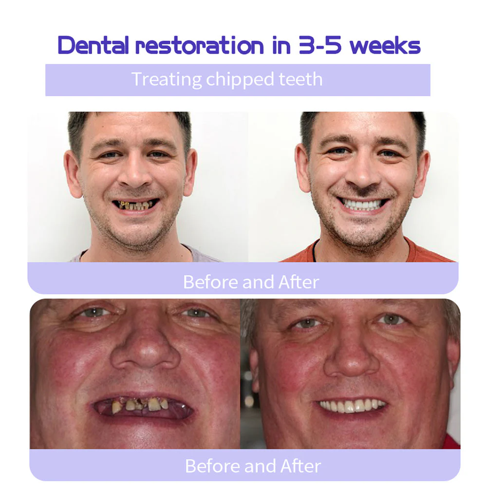 DENTASHIELD – Restore Your Natural Dental Bio-Barrier + 50% OFF FLASH SALE - Image 6