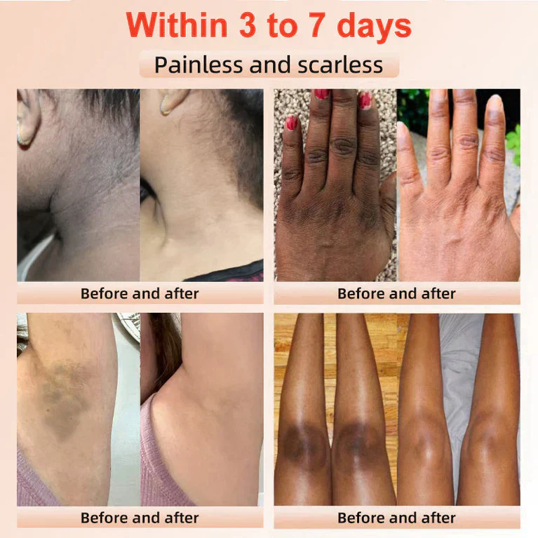 The GlowPeel™ Exfoliating Gel - Brighter, Clearer Skin in One Wipe + 50% OFF - Image 8