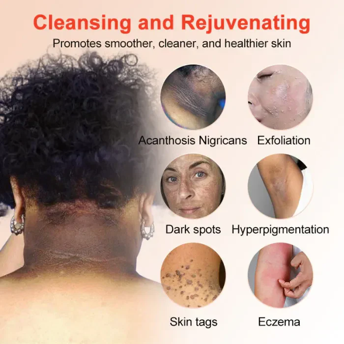 The GlowPeel™ Exfoliating Gel - Brighter, Clearer Skin in One Wipe + 50% OFF - Image 9