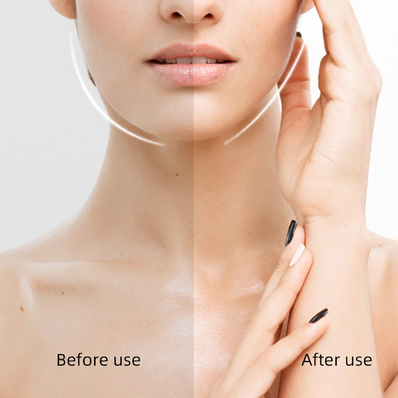 V-Contour Secret - Look 10 Years Younger Instantly + Buy 1 Get 1 FREE - Image 9